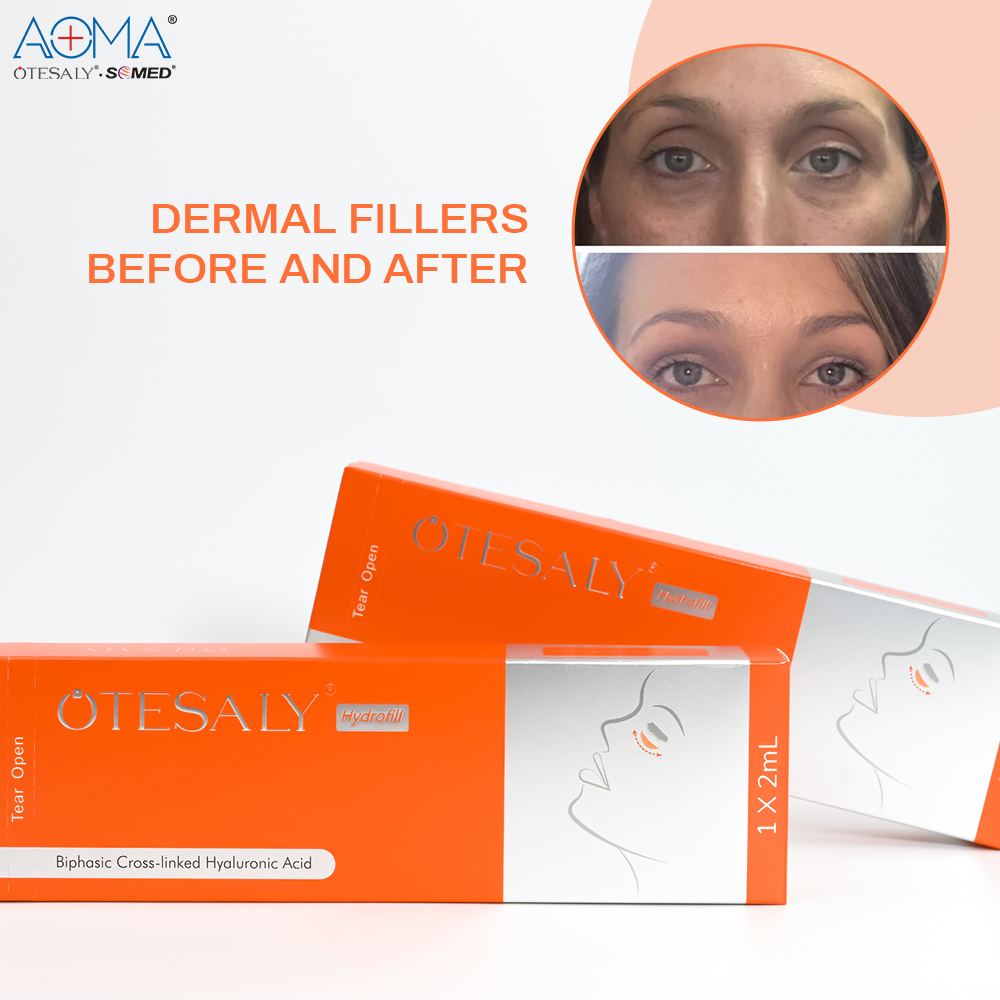 Relleno d&eacute;rmico AOMA Hydrofill