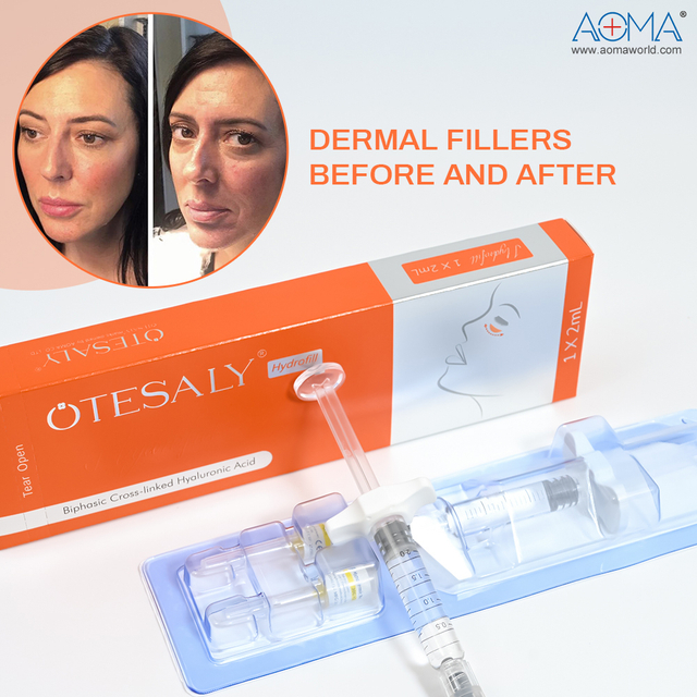 Hidratante Reversible Hydrofill 2ml para Ojeras