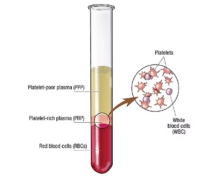 Muestras de sangre para el tratamiento con PRP