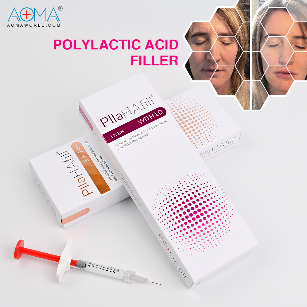 ¿Cuáles son los beneficios del relleno dérmico antes y después?