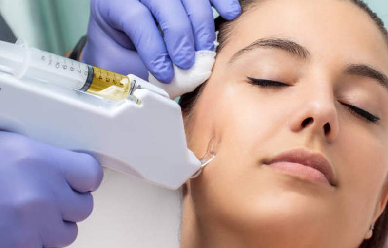 Tratamiento de mesoterapia y pautas de seguridad en 2025 AOMA