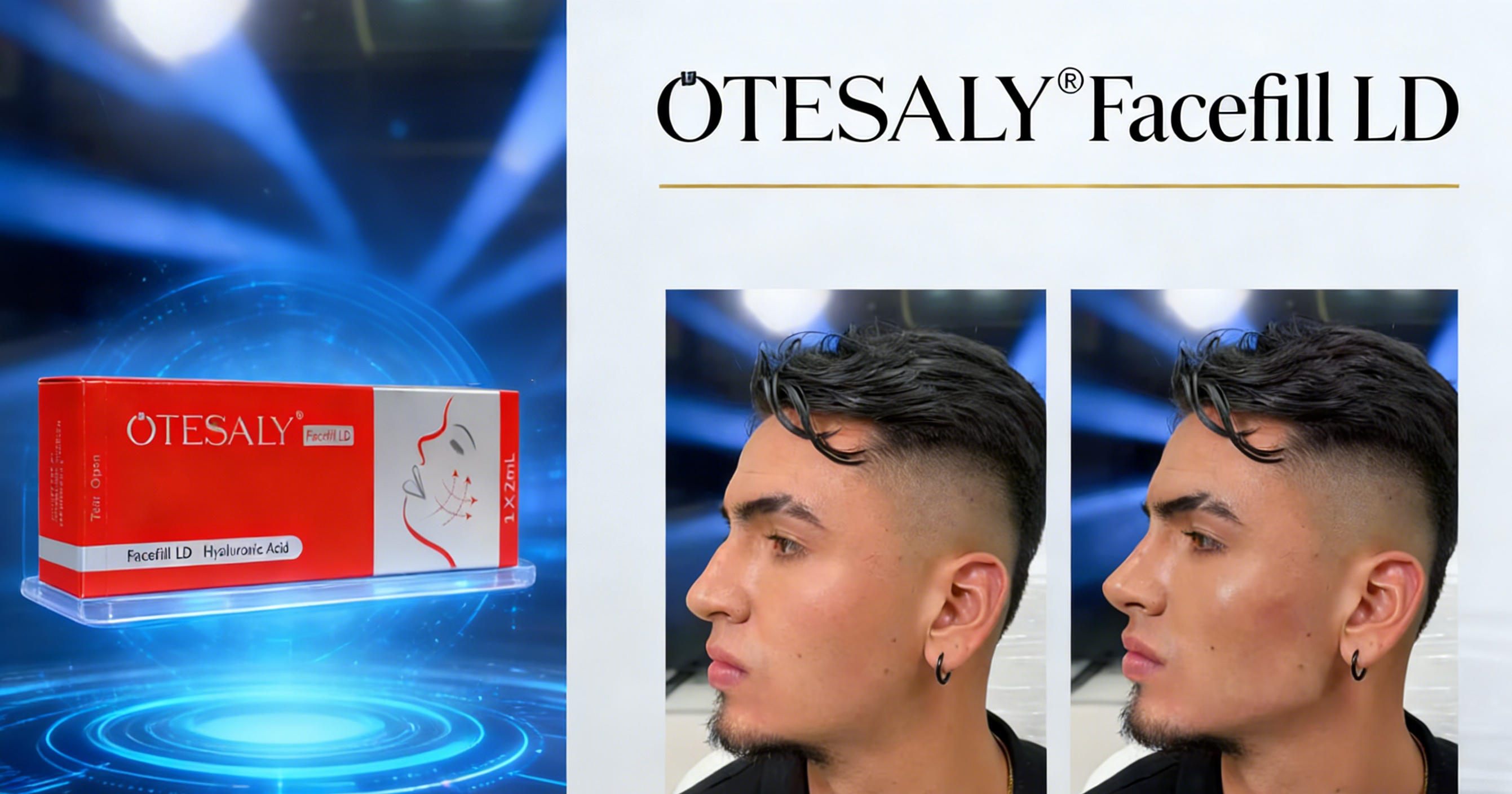 Otesaly Facefill LD aomaworld