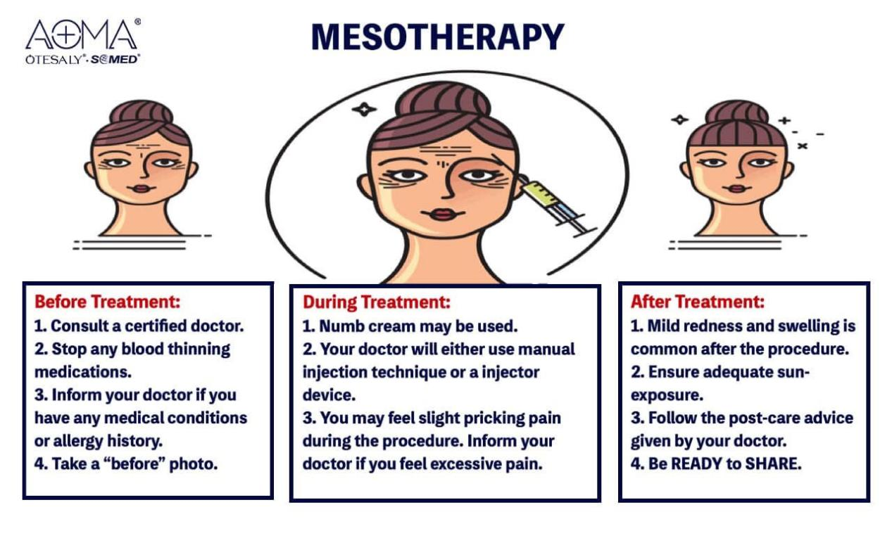 Qu&eacute; hacer antes, durante y despu&eacute;s del tratamiento con soluci&oacute;n de mesoterapia