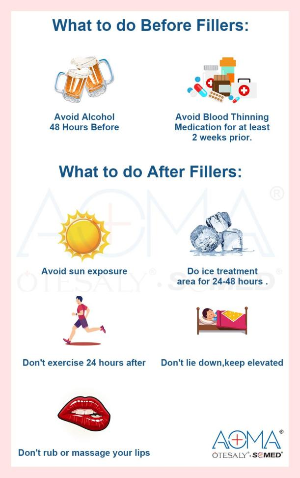 Qu&eacute; hacer antes de los rellenos d&eacute;rmicos