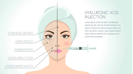 Dermal Filler Top Picks for Lips Cheeks & Body Augmentation_611_343.png