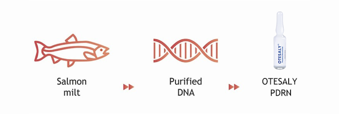 Inyecci&oacute;n de AOMA PDRN