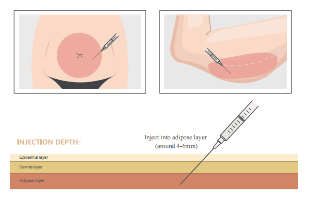 Mecanismo de acci&oacute;n de la semaglutida