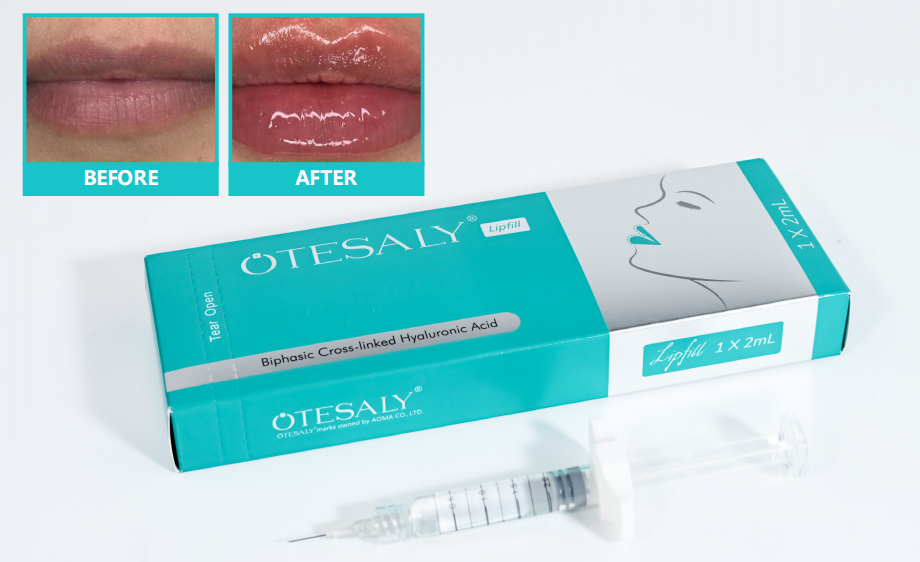 AOMA Relleno de labios 2ml