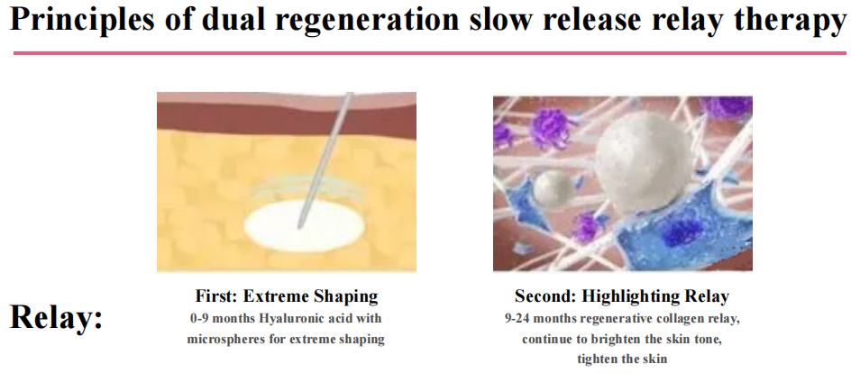 C&oacute;mo funciona el relleno PLLA