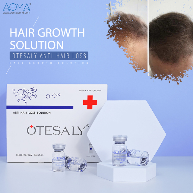 Expertos en caída del cabello Crecimiento del cabello Inyección Mesoterapia Restauración del cabello