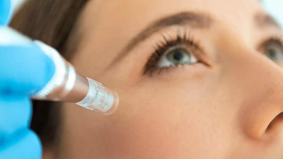 soluci&oacute;n de mesoterapia