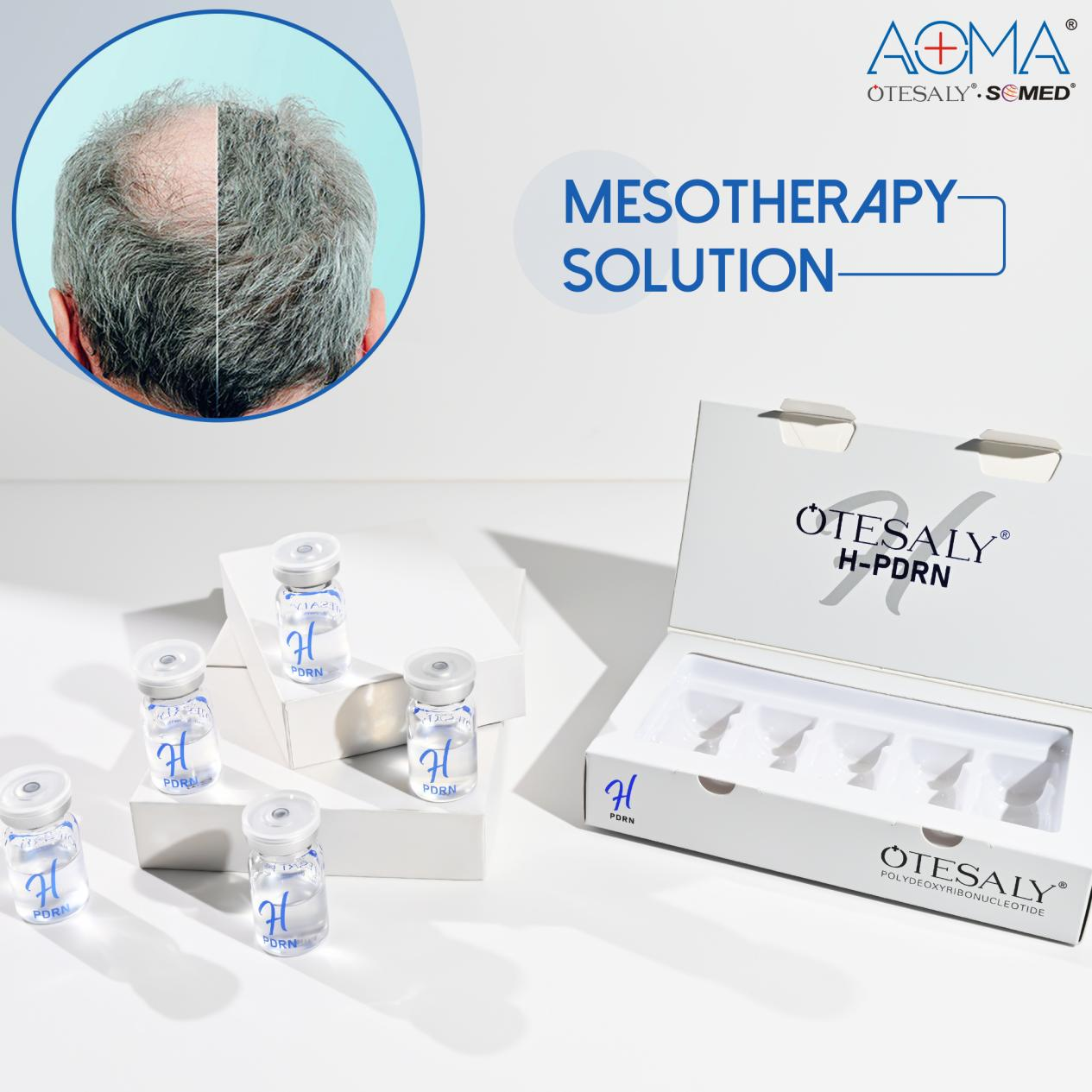 Impulse el crecimiento del cabello con inyecciones de mesoterapia para cabello más grueso