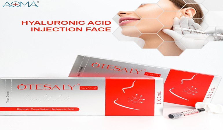 Relleno de pliegue nasolabial antes y después: caso de longevidad de 18 meses