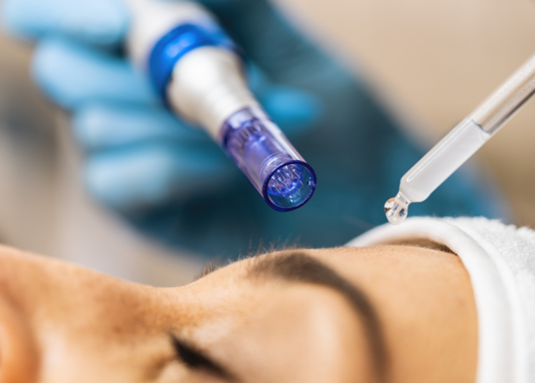 Explicaci&oacute;n del &aacute;cido hialur&oacute;nico Skinbooster