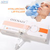 Relleno facial reticulado de 2 ml para pliegues nasolabiales