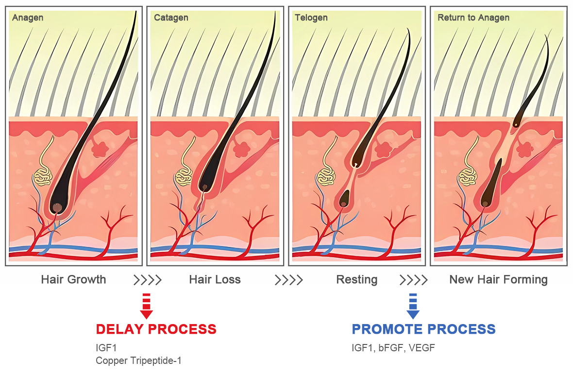 &iquest;C&oacute;mo promueve la mesoterapia para el crecimiento del cabello un cabello m&aacute;s grueso?