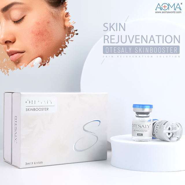 Inyección de ácido hialurónico en gel dérmico para pieles apagadas