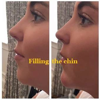 Llenando el ment&oacute;n para AOMA