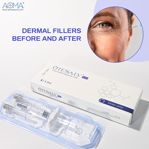 Contorno de volumen facial de relleno de inyección de lidocaína premium de 2 ml