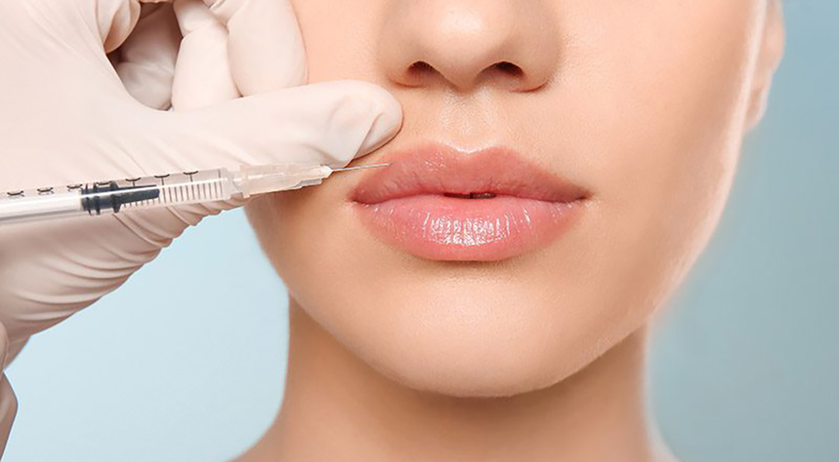 Explorando los mejores rellenos dérmicos de ácido hialurónico para el aumento de labios