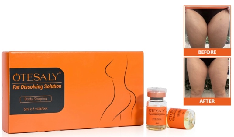 Contorno no quirúrgico: uso de mesoterapia para reducir la papada