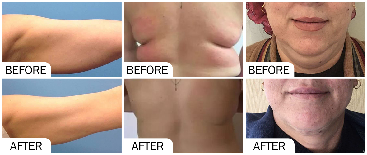 Antes y despu&eacute;s de AOMA para disolver grasas