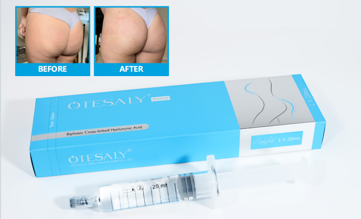 Relleno corporal AOMA