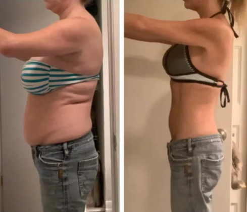 Semaglutida para bajar de peso